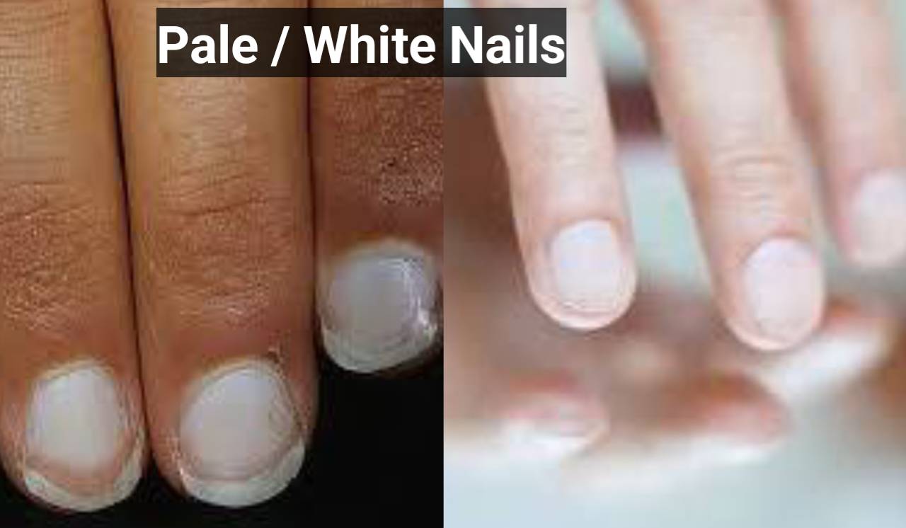 Pale and white nails